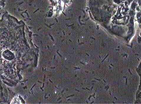 candida 1