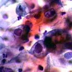 Δοκιμασία οξικού οξέως