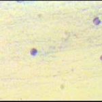 Κύτταρα ενδομητρίου, μεγέθυνση 10Χ40