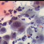 Κυτταρα ενδοτραχήλου 